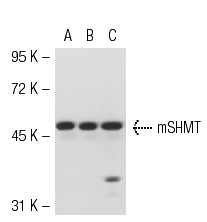 mSHMT (C-20): sc-25064. Western blot analysis of mSHMT expression in non-transfected 293T: sc-117752 (A), mouse mSHMT transfected 293T: sc-121800 (B) and MCF7 (C) whole cell lysates.