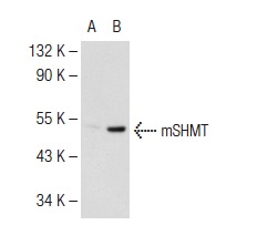 mSHMT (C-20): sc-25064. Western blot analysis of mSHMT expression in non-transfected: sc-117752 (A) and mouse mSHMT transfected: sc-110428 (B) 293T whole cell lysates.