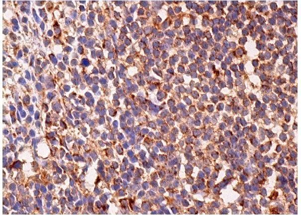 mSHMT (C-20): sc-25064. Immunoperoxidase staining of formalin fixed, paraffin-embedded human lymph node tissue showing cytoplasmic staining of cells in germinal and non-germinal centers.