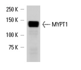 MYPT1 (H-130): sc-25618. Western blot analysis of MYPT1 expression in DU 145 whole cell lysate.