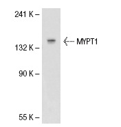 MYPT1 (H-130): sc-25618. Western blot analysis of MYPT1 expression in 3T3-L1 whole cell lysate.