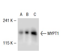 MYPT1 (H-130): sc-25618. Western blot analysis of MYPT1 expression in non-transfected 293T: sc-117752 (A), human MYPT1 transfected 293T: sc-112086 (B) and DU 145 (C) whole cell lysates.