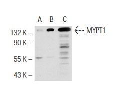 MYPT1 (H-130): sc-25618. Western blot analysis of MYPT1 expression in non-transfected 293T: sc-117752 (A), human MYPT1 transfected 293T: sc-114575 (B) and 3T3-L1 (C) whole cell lysates.