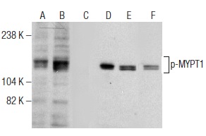 Western blot analysis of MYPT1 phosphorylation in untreated (A,D), Calyculin A treated (B,E) and Calyculin A and lambda protein phosphatase (sc-200312A) treated (C,F) HeLa whole cell lysates. Antibodies tested include p-MYPT1 (F-11): sc-377531 (A,B,C) and MYPT1 (H-130): sc-25618 (D,E,F).