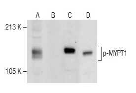 Western blot analysis of MYPT1 phosphorylation in untreated (A,C) and lambda protein phosphatase (sc-200312A) treated (B,D) HeLa whole cell lysates. Antibodies tested include p-MYPT1 (F-11): sc-377531 (A,B) and MYPT1 (H-130): sc-25618 (C,D).