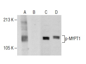 Western blot analysis of MYPT1 phosphorylation in untreated (A,C) and lambda protein phosphatase (sc-200312A) treated (B,D) HCT-8 whole cell lysates. Antibodies tested include p-MYPT1 (F-11): sc-377531 (A,B) and MYPT1 (H-130): sc-25618 (C,D).