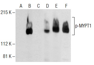 Western blot analysis of MYPT1 phosphorylation in untreated (A,D), induction cocktail (sc-362324) treated (B,E) and induction cocktail (sc-362324) and lambda protein phosphatase (sc-200312A) treated (C,F) HeLa whole cell lysates. Antibodies tested include p-MYPT1 (A-6): sc-377542 (A,B,C) and MYPT1 (H-130): sc-25618 (D,E,F).