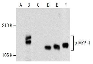 Western blot analysis of MYPT1 phosphorylation in untreated (A,D), Ser/Thr induction cocktail (sc-362324) treated (B,E) and Ser/Thr induction cocktail (sc-362324) and lambda protein phosphatase (sc-200312A) treated (C,F) HeLa whole cell lysates. Antibodies tested include p-MYPT1 (Ser 695): sc-33360 (A,B,C) and MYPT1 (H-130): sc-25618 (D,E,F).