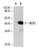 NCK1/2 (C-19): sc-290. Western blot analysis of NCK1 expression in non-transfected: sc-117752 (A) and mouse NCK1 transfected: sc-121953 (B) 293T whole cell lysates.