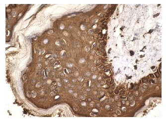 NCK1/2 (C-19): sc-290. Immunoperoxidase staining of formalin fixed, paraffin-embedded human skin tissue showing cytoplasmic and nuclear staining of epidermal cells.