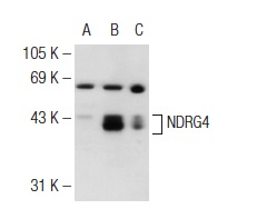 NDRG4 (39-V): sc-100788. Western blot analysis of NDRG4 expression in non-transfected 293T: sc-117752 (A), human NDRG4 transfected 293T: sc-129236 (B) and IMR-32 (C) whole cell lysates.
