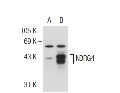 NDRG4 (39-V): sc-100788. Western blot analysis of NDRG4 expression in non-transfected: sc-117752 (A) and human NDRG4 transfected: sc-177608 (B) 293T whole cell lysates.
