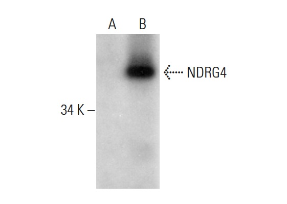 NDRG4 (39-V): sc-100788. Western blot analysis of NDRG4 expression in non-transfected: sc-117752 (A) and human NDRG4 transfected: sc-369549 (B) 293T whole cell lysates.