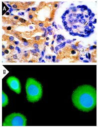 VEGF (A-20): sc-152. Immunoperoxidase staining of formalin-fixed, paraffin-embedded normal human kidney showing diffuse cytoplasmic staining of kidney tubules (A). Immunofluorescence staining of PMA-treated, methanol-fixed SK-BR-3 cells, showing cytoplasmic fluorescein immunostaining and nuclear DAPI counterstain (B).