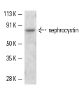 nephrocystin (C-20): sc-20204. Western blot analysis of nephrocystin expression in mouse embryo tissue extract.