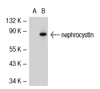 nephrocystin (C-20): sc-20204. Western blot analysis of nephrocystin expression in non-transfected: sc-117752 (A) and human nephrocystin transfected: sc-116755 (B) 293T whole cell lysates.
