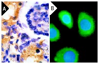 VEGF (A-20): sc-152. Immunoperoxidase staining of formalin-fixed, paraffin-embedded normal human kidney showing diffuse cytoplasmic staining of kidney tubules (A). Immunofluorescence staining of PMA-treated, methanol-fixed SK-BR-3 cells, showing cytoplasmic fluorescein immunostaining and nuclear DAPI counterstain (B).