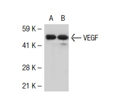 VEGF (A-20): sc-152. Western blot analysis of VEGF expression in non-transfected: sc-117752 (A) and human VEGF transfected: sc-117031 (B) 293T whole cell lysates.