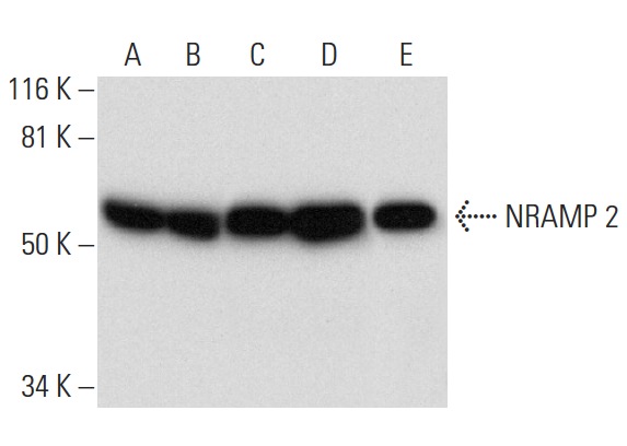 NRAMP 2 (G-5): sc-166884. Western blot analysis of NRAMP 2 expression in J774.A1 (A), RAW 264.7 (B), NAMALWA (C) and Hep G2 (D) whole cell lysates and human liver tissue extract (E).
