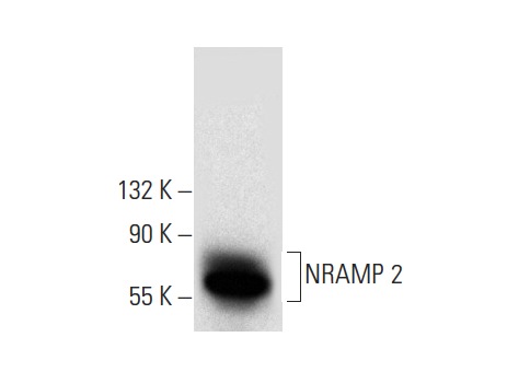 NRAMP 2 (G-5): sc-166884. Western blot analysis of NRAMP 2 expression in U-937 (A), RAW 264.7 (B), NAMALWA (C) and Hep G2 (D) whole cell lysates.