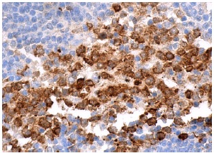 Op18 (A-4): sc-48362. Immunoperoxidase staining of formalin fixed, paraffin-embedded human lymph node tissue showing cytoplasmic staining of cells in germinal center.