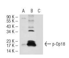 p-Op18 (Ser 16)-R: sc-12948-R. Western blot analysis of Op18 (Ser 16) phosphorylation in untreated (A), PMA-treated (B) and PMA and lambda protein phosphatase treated (C) Jurkat whole cell lystates.