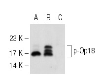 Western blot analysis of Op18 phosphorylation in untreated (A,D), PMA treated (B,E) and PMA and lambda protein phosphatase treated (C,F) Jurkat whole cell lysates. Antibodies tested include p-Op18 (Ser 16)-R: sc-12948-R (A,B,C) and Op18 (FL-149): sc-20796 (D,E,F).