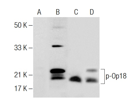 Western blot analysis of Op18 phosphorylation in untreated (A,C) and activator cocktail (sc-362324) treated (B,D) Jurkat whole cell lysates. Antibodies tested include p-Op18 (Ser 16)-R: sc-12948-R (A,B) and Op18 (A-4): sc-48362 (C,D).
