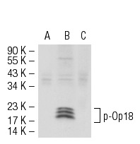 p-Op18 (Ser 25): sc-101809. Western blot analysis of Op18 (Ser 25) phosphorylation in untreated (A), PMA-treated (B) and PMA and lambda protein phosphatase treated (C) Jurkat whole cell lystates.