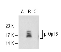 p-Op18 (Ser 25): sc-101809. Western blot analysis of Op18 phosphorylation in untreated (A), PMA treated (B) and PMA and lambda protein phosphatase treated (C) Jurkat whole cell lysates