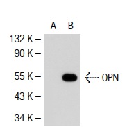 OPN (AKm2A1): sc-21742. Western blot analysis of OPN expression in non-transfected: sc-117752 (A) and mouse OPN transfected: sc-122246 (B) 293T whole cell lysates.