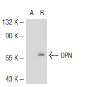 OPN (AKm2A1): sc-21742. Western blot analysis of OPN expression in non-transfected: sc-117752 (A) and mouse OPN transfected: sc-122247 (B) 293T whole cell lysates.