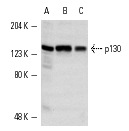 p130 (C-20)-G: sc-317-G. Western blot analysis of p130 expression in untreated (A) and phorbol ester-treated (B) Jurkat whole cell lysates and C32 nuclear extract (C).
