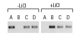 ChIP analysis of c-Myc promoter occupancy in response to lithium stimulation in serum synchronized C2C12 cells. Antibodies tested include HDAC1 (H-15): sc-7872, HDAC1 (C-19): sc-6298 and HDAC1 (H-11): sc-8410 (A), β-catenin (H-120): sc-7199, β-catenin (C-18): sc-1496 and β-catenin (E-5): sc-7963 (B), E2F-4 (A-20): sc-1082, E2F-4 (D-3): sc-6851, E2F-4 (RK-13): sc-511 and E2F-4 (C-20): sc-866 (C), and p130 (C-20): sc-317, p130 (211.6): sc-9963 and p130 (H-125): sc-20678 (D). Data kindly provided by M.G. Rosenfeld and reproduced with permission from Proc. Natl. Acad. Sci. 100: 3245-3250. Copyright 2003 National Academy of Sciences, USA.