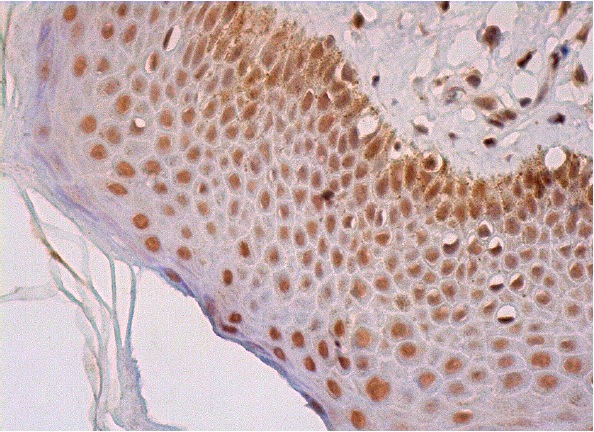 p130 (C-20)-G: sc-317-G. Immunoperoxidase staining of formalin fixed, paraffin-embedded human vulva/anal skin tissue showing nuclear staining of epidermal cells.