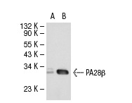 PA28β (L-19): sc-23642. Western blot analysis of PA28β expression in non-transfected: sc-117752 (A) and human PA28β transfected: sc-114006 (B) 293T whole cell lysates.