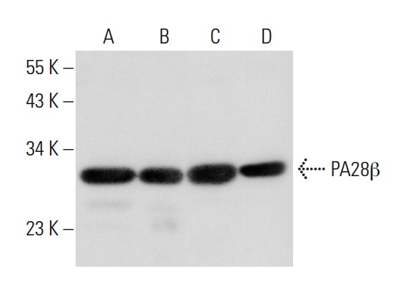 PA28β (L-19): sc-23642. Western blot analysis of PA28β expression in human spleen (A) and human liver (B) tissue extracts and Hep G2 (C) and HL-60 (D) whole cell lysates.
