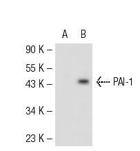 PAI-1 (C-9): sc-5297. Western blot analysis of PAI-1 expression in non-transfected: sc-110760 (A) and human PAI-1 transfected: sc-111254 (B) 293 whole cell lysates.