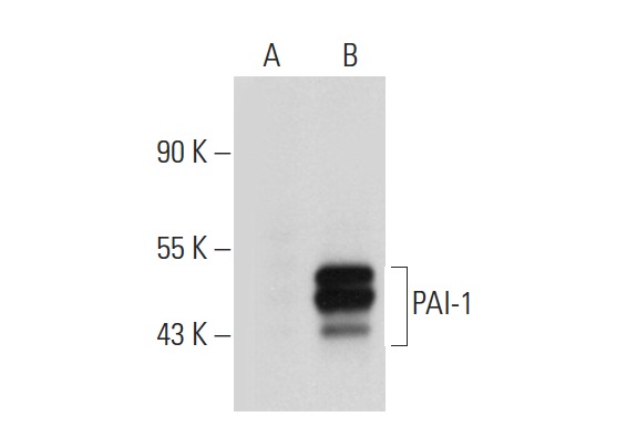 PAI-1 (C-9): sc-5297. Western blot analysis of PAI-1 expression in non-transfected: sc-117752 (A) and human PAI-1 transfected: sc-158803 (B) 293T whole cell lysates.