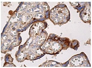 PAI-1 (C-9): sc-5297. Immunoperoxidase staining of formalin fixed, paraffin-embedded human placenta tissue showing cytoplasmic staining of trophoblastic cells.