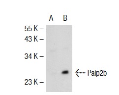 Paip2 (H-20): sc-18617. Western blot analysis of Paip2 expression in non-transfected: sc-117752 (A) and mouse Paip2 transfected: sc-122359 (B) 293T whole cell lysates.