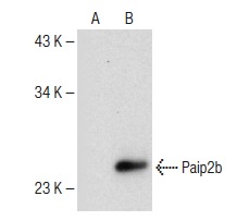Paip2 (H-20): sc-18617. Western blot analysis of Paip2b expression in non-transfected: sc-117752 (A) and mouse Paip2b transfected: sc-122360 (B) 293T whole cell lysates.