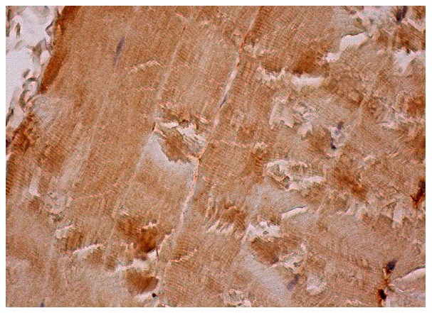 PARD6B (H-64): sc-67392. Immunoperoxidase staining of formalin fixed, paraffin-embedded human skeletal muscle tissue showing cytoplasmic staining of myocytes.