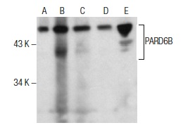 PARD6B (H-64): sc-67392. Western blot analysis of PARD6B expression in RAW 264.7 whole cell lysate (A) and rat spleen (B), mouse spleen (C), mouse pancreas (D) and rat pancreas (E) tissue extracts.