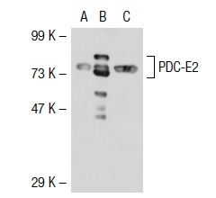 PDC-E2 (H-160): sc-32925. Western blot analysis of PDC-E2 expression in non-transfected 293T: sc-117752 (A), mouse PDC-E2 transfected 293T: sc-122447 (B) and HeLa (C) whole cell lysates.