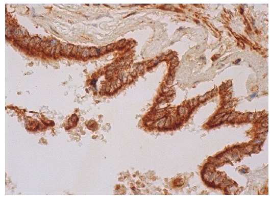 PDC-E2 (H-160): sc-32925. Immunoperoxidase staining of formalin fixed, paraffin-embedded human bronchus tissue showing cytoplasmic staining of respiratory epithelial cells and smooth muscle cells.