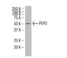 PEPD (47-Q): sc-100708. Western blot analysis of PEPD expression in Hep G2 whole cell lysate.