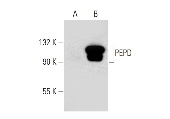 PEPD (47-Q): sc-100708. Western blot analysis of PEPD expression in non-transfected: sc-117752 (A) and human PEPD transfected: sc-158843 (B) 293T whole cell lysates.
