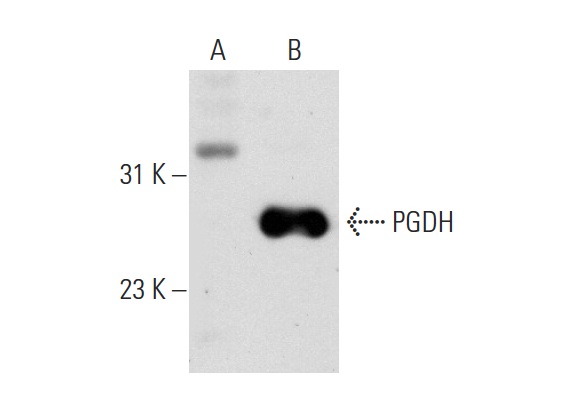 PGDH (FL-266): sc-98907. Western blot analysis of PGDH expression in non-transfected: sc-117752 (A) and mouse PGDH transfected: sc-122517 (B) 293T whole cell lysates.