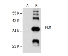 PI31 (26): sc-136416. Western blot analysis of PI31 expression in non-transfected: sc-117752 (A) and human PI31 transfected: sc-373110 (B) 293T whole cell lysates.